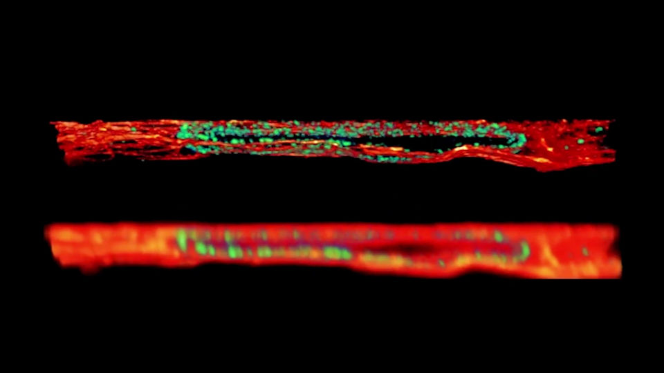 Image of Nuclear pore complexes (NUP) and Tubulin